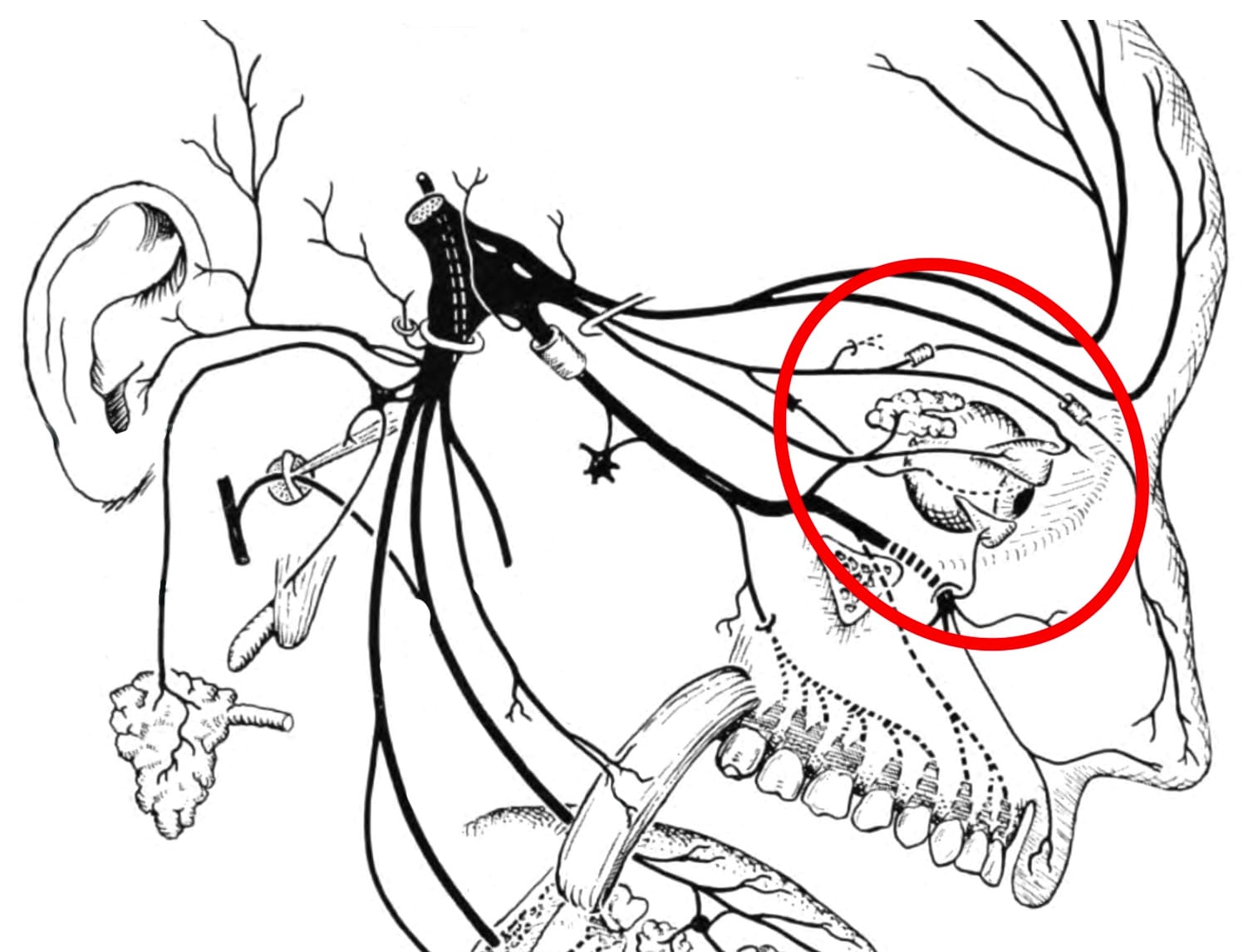 trigeminal nerve