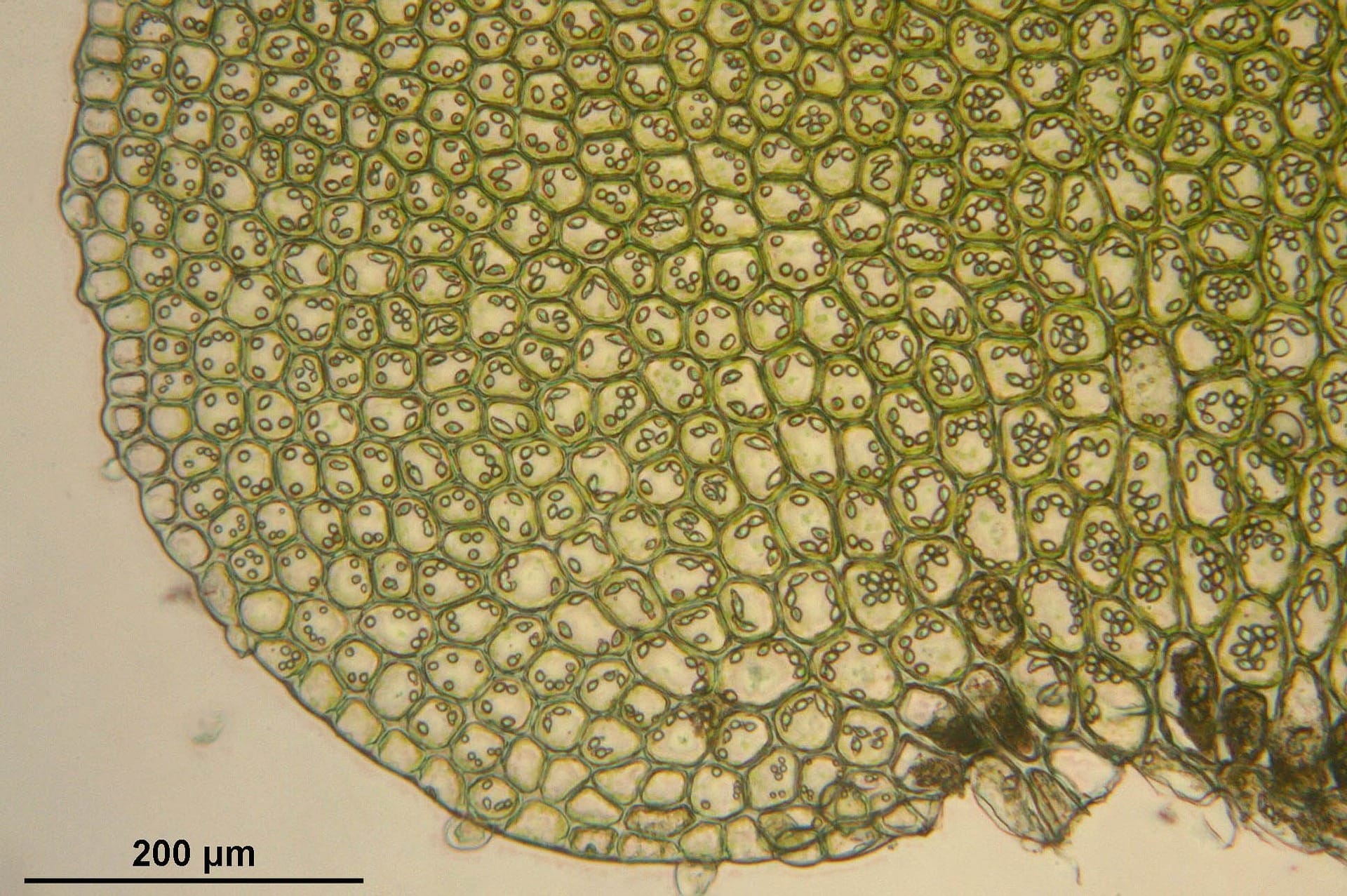 chloroplasts