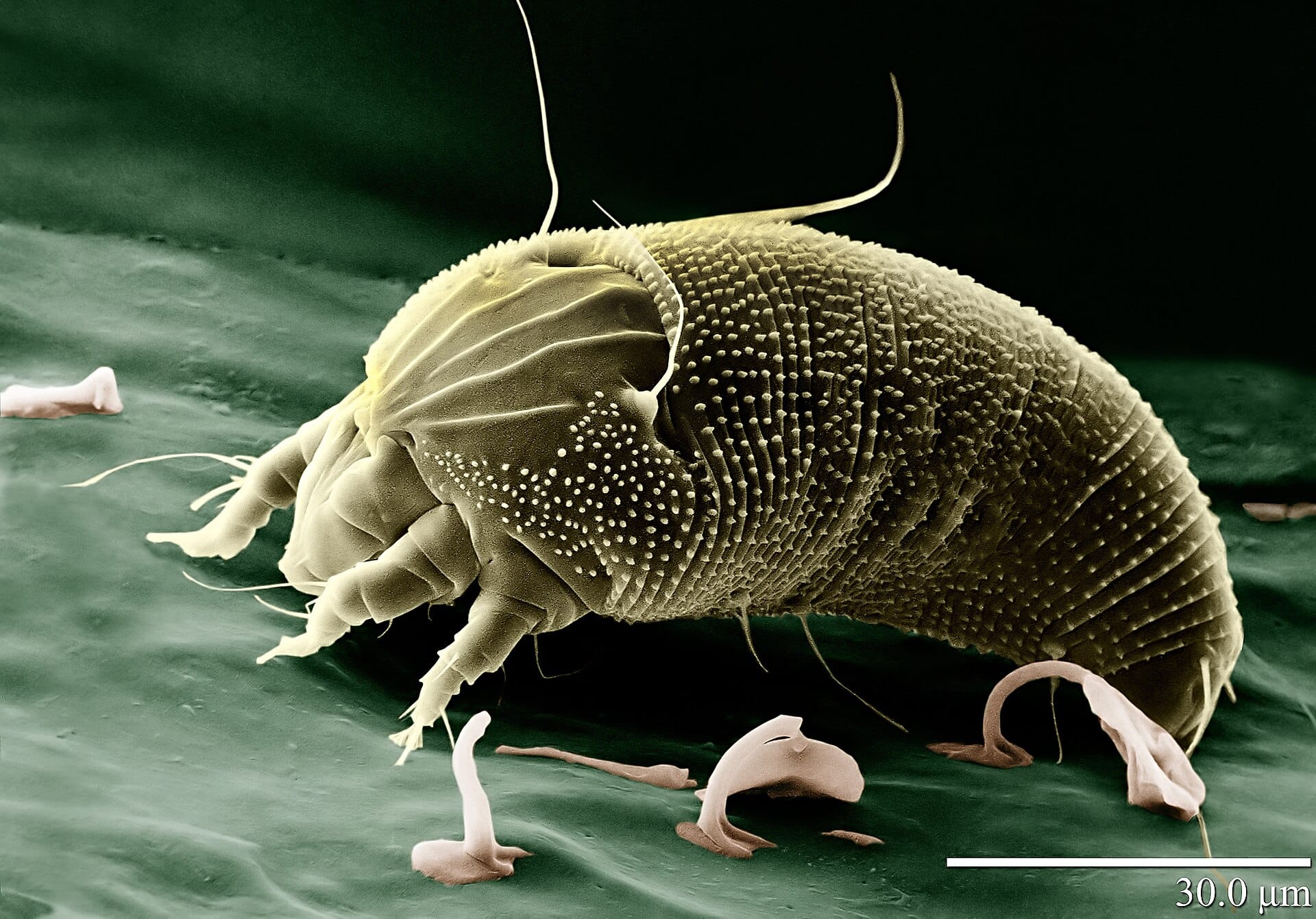 microscopic view of a mite