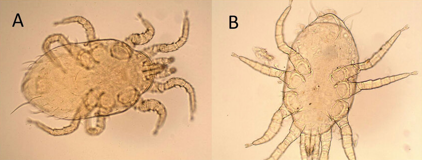 microscopic views of mites